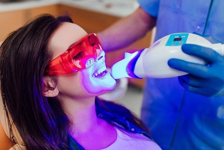 In-Office Whitening